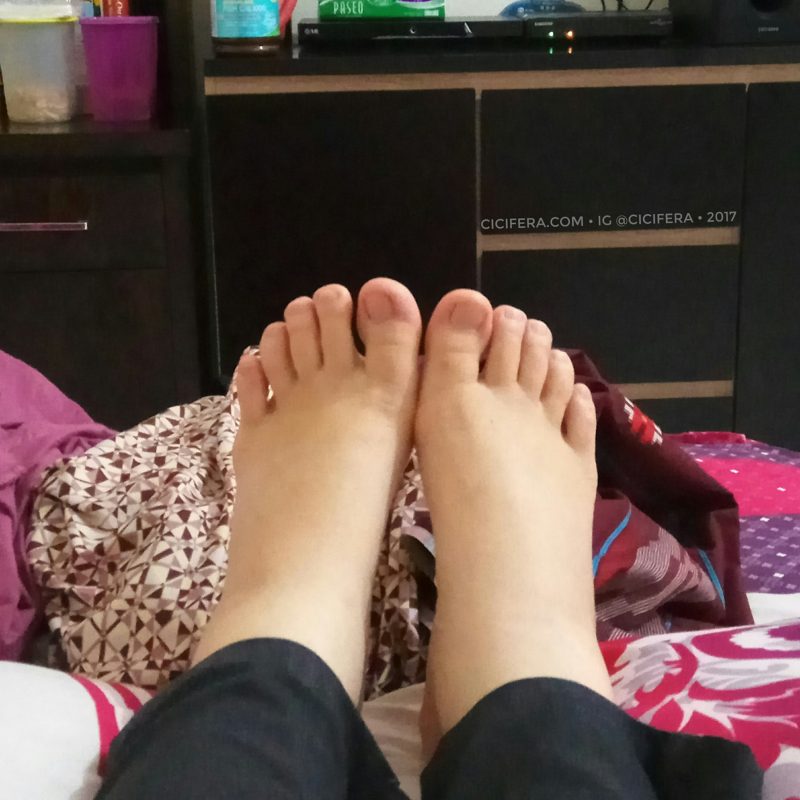 Edema, Bengkak Kaki Pada Ibu Hamil. Bahaya ga ya? - @cicifera