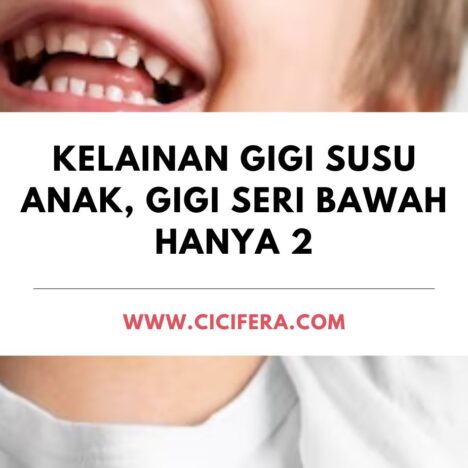Cara Menghilangkan Plak Gigi Anak dan Tips Mencegahnya