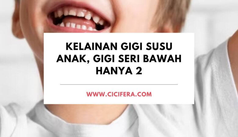 Kelainan Gigi Susu Anak, Gigi Seri Bawah Hanya 2 Kelainan Gigi Susu Anak